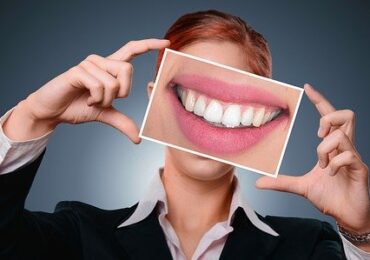 How Can Dental Lumineers Benefit You?