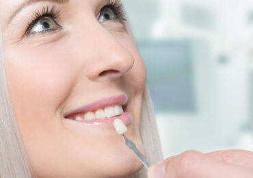 Teeth Whitening vs. Veneers: Which One is Best?