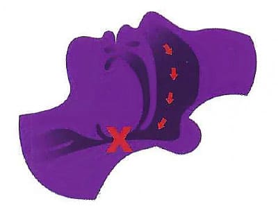 OSA Dr. Stephen Petinge, DMD. Stephen Petinge DMD. General, Cosmetic, Restorative, Preventative, Family Dentist, Dental Implants, TMJ/TMD, Emergency Dentistry, Crowns & Bridges, Teeth Whitening, Sleep Apnea Appliances, Sedation dentistry . Dentist in Saugus, MA 01906 Top-notch dentist in Saugus, MA 01906